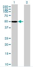 Western blot - PAK1 overexpression 293T lysate (whole cell) (AB94241)