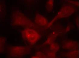 Immunocytochemistry/ Immunofluorescence - Anti-PAK1 + PAK2 + PAK3 antibody (AB131547)