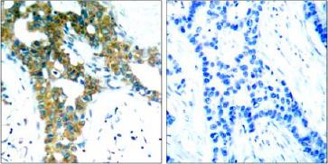 Immunohistochemistry (Formalin/PFA-fixed paraffin-embedded sections) - Anti-PAK1 + PAK2 + PAK3 antibody (AB131547)