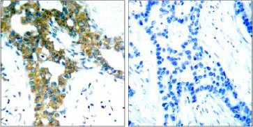 Immunohistochemistry (Formalin/PFA-fixed paraffin-embedded sections) - Anti-PAK1 + PAK2 + PAK3 antibody (AB131547)
