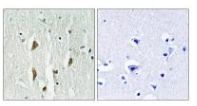 Immunohistochemistry (Formalin/PFA-fixed paraffin-embedded sections) - Anti-PAK1 + PAK2 + PAK3 antibody (AB196834), expandable thumbnail