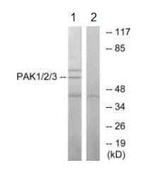 Western blot - Anti-PAK1 + PAK2 + PAK3 antibody (AB196834)