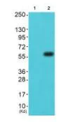 Western blot - Anti-PAK1 + PAK2 + PAK3 antibody (AB196834)