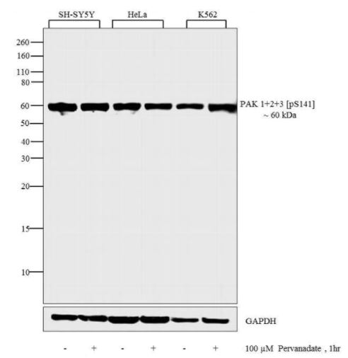 Western blot - Anti-PAK1 + PAK2 + PAK3 (phospho S141) antibody (AB5247)