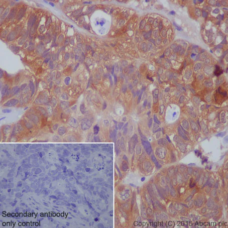 Immunohistochemistry (Formalin/PFA-fixed paraffin-embedded sections) - Anti-PAK1 (phospho S144) + PAK2 (phospho S141) + PAK3 (phospho S154) antibody [EP656Y] (AB40795)