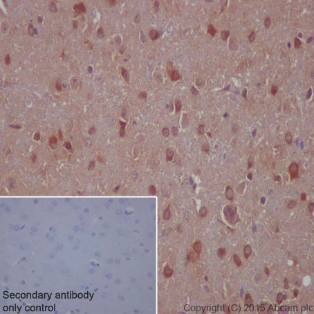 Immunohistochemistry (Formalin/PFA-fixed paraffin-embedded sections) - Anti-PAK1 (phospho S144) + PAK2 (phospho S141) + PAK3 (phospho S154) antibody [EP656Y] (AB40795)