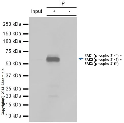 Immunoprecipitation - Anti-PAK1 (phospho S144) + PAK2 (phospho S141) + PAK3 (phospho S154) antibody [EP656Y] (AB40795)