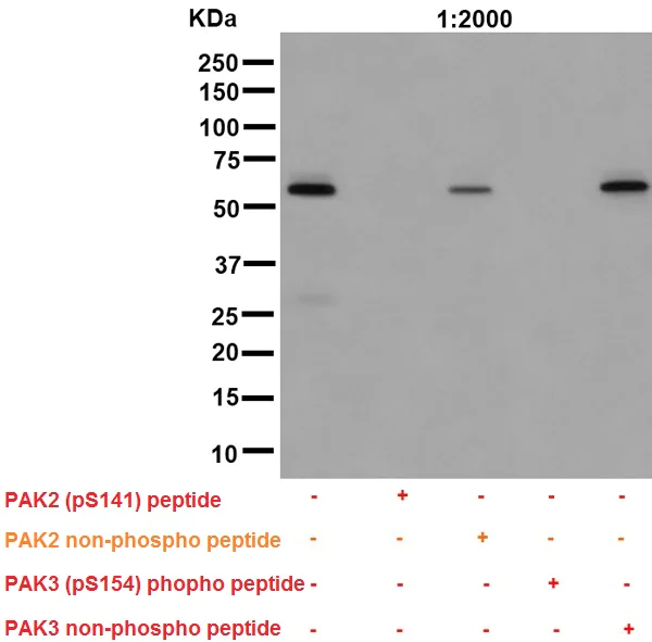 Western blot - Anti-PAK1 (phospho S144) + PAK2 (phospho S141) + PAK3 (phospho S154) antibody [EP656Y] (AB40795)