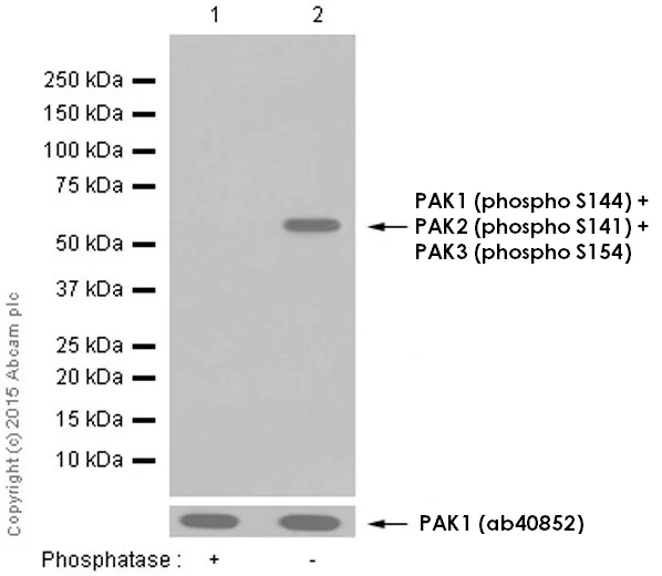 Western blot - Anti-PAK1 (phospho S144) + PAK2 (phospho S141) + PAK3 (phospho S154) antibody [EP656Y] (AB40795)