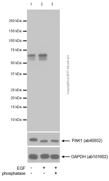 Western blot - Anti-PAK1 (phospho S144) + PAK2 (phospho S141) + PAK3 (phospho S154) antibody [EP656Y] (AB40795)