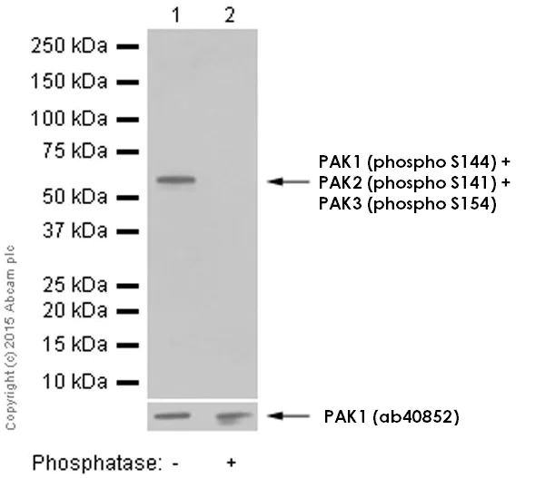 Western blot - Anti-PAK1 (phospho S144) + PAK2 (phospho S141) + PAK3 (phospho S154) antibody [EP656Y] (AB40795)