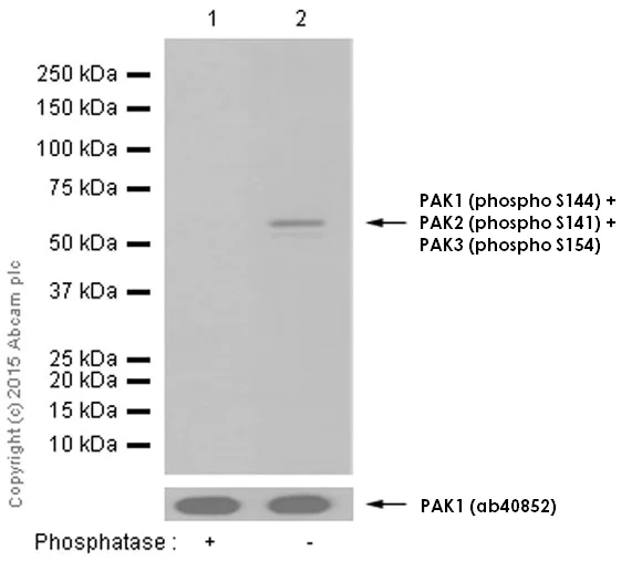 Western blot - Anti-PAK1 (phospho S144) + PAK2 (phospho S141) + PAK3 (phospho S154) antibody [EP656Y] (AB40795)