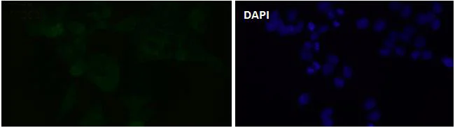 Immunocytochemistry/ Immunofluorescence - Anti-PAK1 (phospho S144) + PAK2 (phospho S141) +PAK3 (phospho S154) antibody [SU03-70] (AB326621)