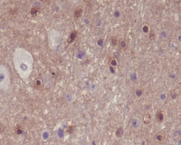 Immunohistochemistry (Formalin/PFA-fixed paraffin-embedded sections) - Anti-PAK1 (phospho S144) + PAK2 (phospho S141) +PAK3 (phospho S154) antibody [SU03-70] (AB326621)