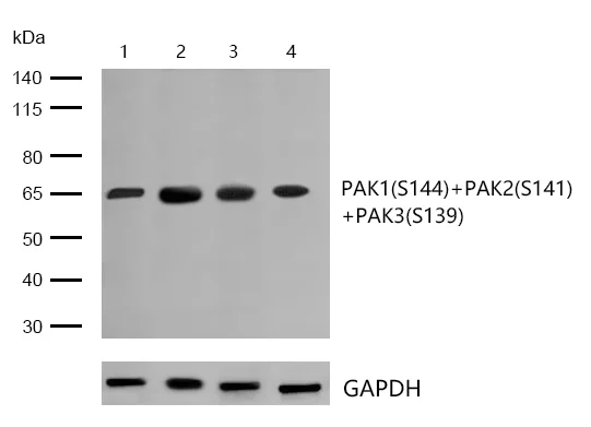 Western blot - Anti-PAK1 (phospho S144) + PAK2 (phospho S141) +PAK3 (phospho S154) antibody [SU03-70] (AB326621)