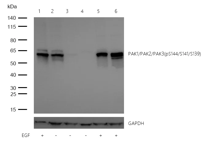 Western blot - Anti-PAK1 (phospho S144) + PAK2 (phospho S141) +PAK3 (phospho S154) antibody [SU03-70] (AB326621)