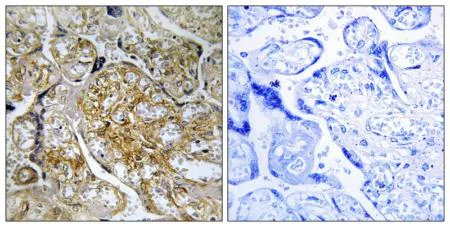 Immunohistochemistry (Formalin/PFA-fixed paraffin-embedded sections) - Anti-PAK1 (phospho S199) antibody (AB192814)