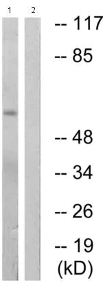 Western blot - Anti-PAK1 (phospho S199) antibody (AB192814)
