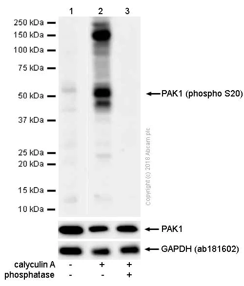 Western blot - Anti-PAK1 (phospho S20) antibody [EP655Y] (AB51244)