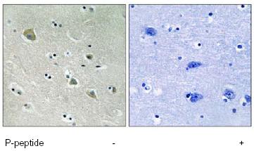 Immunohistochemistry (Formalin/PFA-fixed paraffin-embedded sections) - Anti-PAK1 (phospho S204) antibody (AB79503)