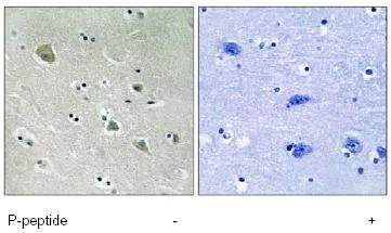 Immunohistochemistry (Formalin/PFA-fixed paraffin-embedded sections) - Anti-PAK1 (phospho S204) antibody (AB79503)