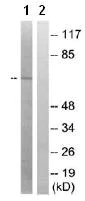 Western blot - Anti-PAK1 (phospho S204) antibody (AB79503)