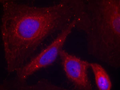 Immunocytochemistry/ Immunofluorescence - Anti-PAK1 (phospho T212) antibody (AB75599)