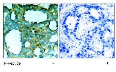Immunohistochemistry (Formalin/PFA-fixed paraffin-embedded sections) - Anti-PAK1 (phospho T212) antibody (AB75599)
