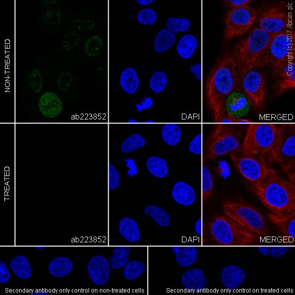 Immunocytochemistry/ Immunofluorescence - Anti-PAK1 (phospho T212) antibody [EPR20045] (AB223852)