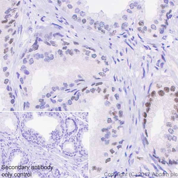 Immunohistochemistry (Formalin/PFA-fixed paraffin-embedded sections) - Anti-PAK1 (phospho T212) antibody [EPR20045] - BSA and Azide free (AB235116)