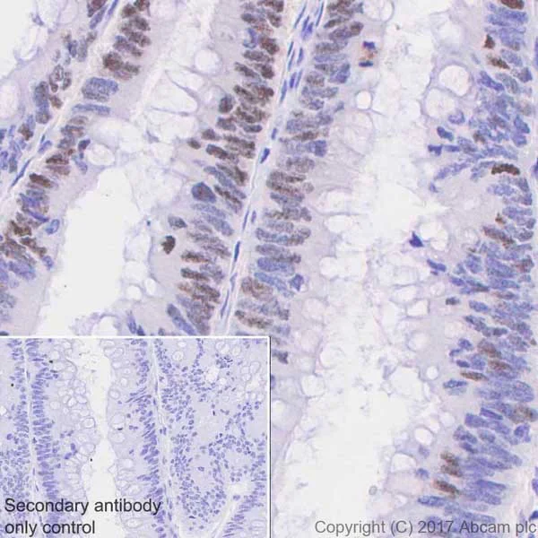 Immunohistochemistry (Formalin/PFA-fixed paraffin-embedded sections) - Anti-PAK1 (phospho T212) antibody [EPR20045] - BSA and Azide free (AB235116)