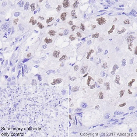 Immunohistochemistry (Formalin/PFA-fixed paraffin-embedded sections) - Anti-PAK1 (phospho T212) antibody [EPR20045] - BSA and Azide free (AB235116)