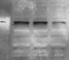 Western blot - Anti-PAK1 (phospho T423) + PAK2 (phospho T402) + PAK3 (phospho T436) antibody (AB2477)