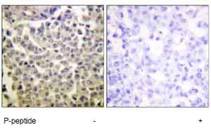 Immunohistochemistry (Formalin/PFA-fixed paraffin-embedded sections) - Anti-PAK1 (phospho T423) + PAK2 (phospho T402 ) + PAK3 (phospho T436) antibody (AB62155)