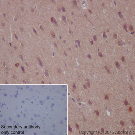 Immunohistochemistry (Formalin/PFA-fixed paraffin-embedded sections) - Anti-PAK1+PAK2+PAK3 (phospho S141 + S144 + S154) antibody [EP656Y] - BSA and Azide free (AB239830)