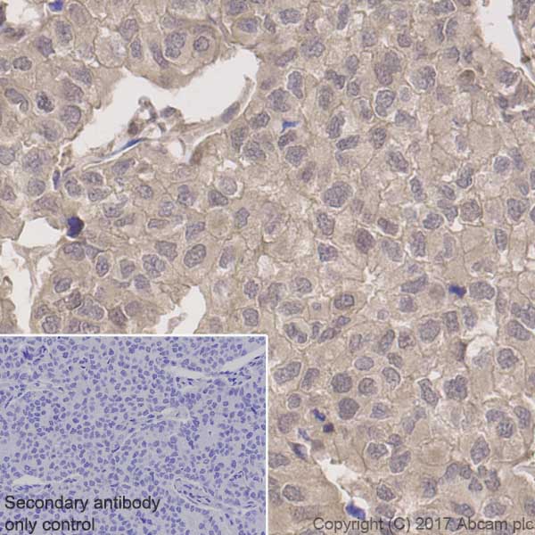 Immunohistochemistry (Formalin/PFA-fixed paraffin-embedded sections) - Anti-PAK2 antibody [EP796Y] (AB76293), expandable thumbnail