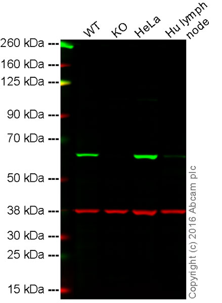 Western blot - Anti-PAK2 antibody [EP796Y] (ab76293), expandable thumbnail