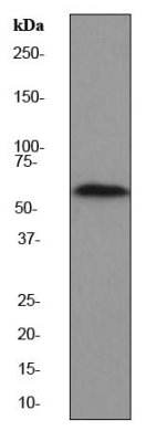 Western blot - Anti-PAK2 antibody [EP796Y] (ab76293), expandable thumbnail
