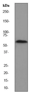 Western blot - Anti-PAK2 antibody [EP796Y] (AB76293)