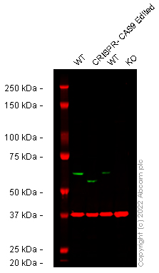 Western blot - Anti-PAK2 antibody [EP796Y] (ab76293), expandable thumbnail