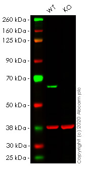 Western blot - Anti-PAK2 antibody [EP796Y] (AB76293), expandable thumbnail