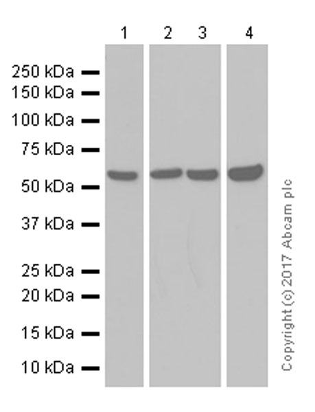 Western blot - Anti-PAK2 antibody [EP796Y] (ab76293), expandable thumbnail