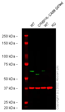 Western blot - Anti-PAK2 antibody [EP796Y] - BSA and Azide free (AB227990)