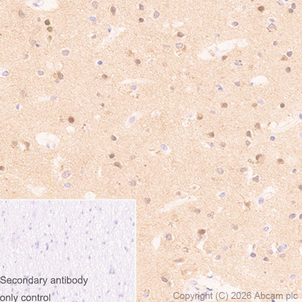 Immunohistochemistry (Formalin/PFA-fixed paraffin-embedded sections) - Anti-PAK3 antibody [EP797Y] (AB40808)