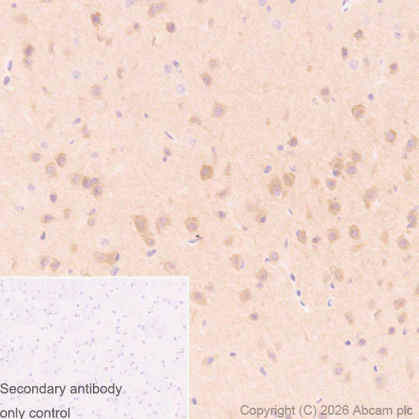Immunohistochemistry (Formalin/PFA-fixed paraffin-embedded sections) - Anti-PAK3 antibody [EP797Y] (AB40808)