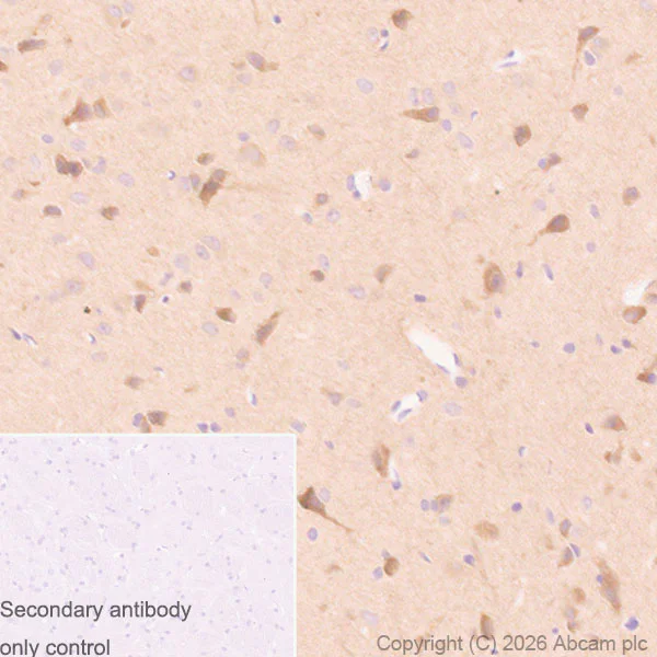 Immunohistochemistry (Formalin/PFA-fixed paraffin-embedded sections) - Anti-PAK3 antibody [EP797Y] (AB40808)