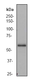 Western blot - Anti-PAK3 antibody [EP797Y] (AB40808), expandable thumbnail