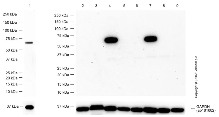 Western blot - Anti-PAK3 antibody [EP797Y] (AB40808)
