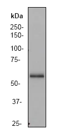 Western blot - Anti-PAK3 antibody [EP797Y] - BSA and Azide free (AB247294)