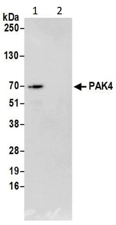 Immunoprecipitation - Anti-PAK4 antibody (AB17974)